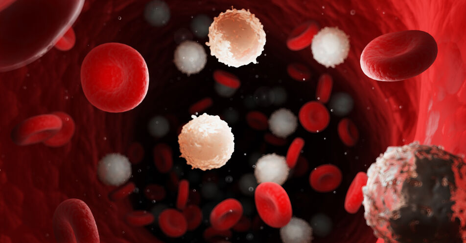 AML und MM: Längeres Überleben mit Azacitidin und CAR-T-Zellen