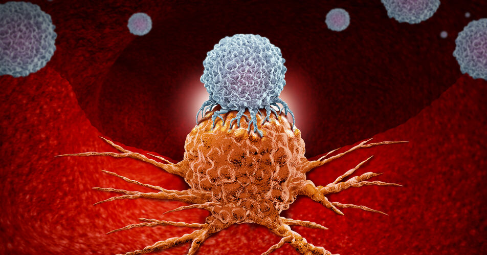Solide Tumoren: Checkpoint-Inhibitor verbessert Heilungschance