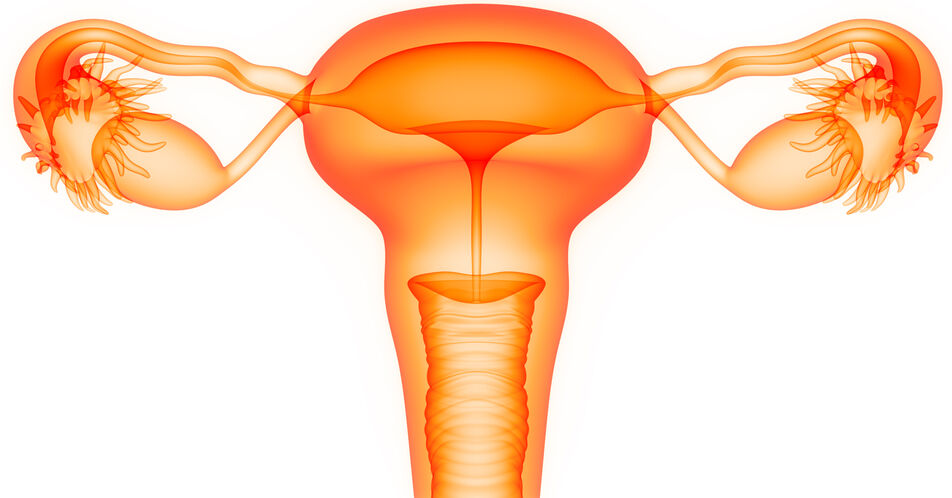ATHENA-Studie: Verbessertes PFS mit Rucaparib-Erhaltungstherapie beim fortgeschrittenen Ovarialkarzinom