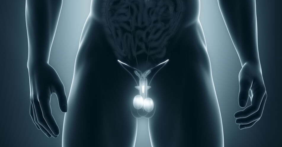 Mesotheliome der Tunica vaginalis des Hodens: Was zu tun ist