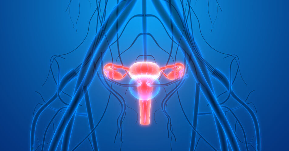 Fortgeschrittenes Ovarialkarzinom: Niraparib verlängert das progressionsfreie Überleben