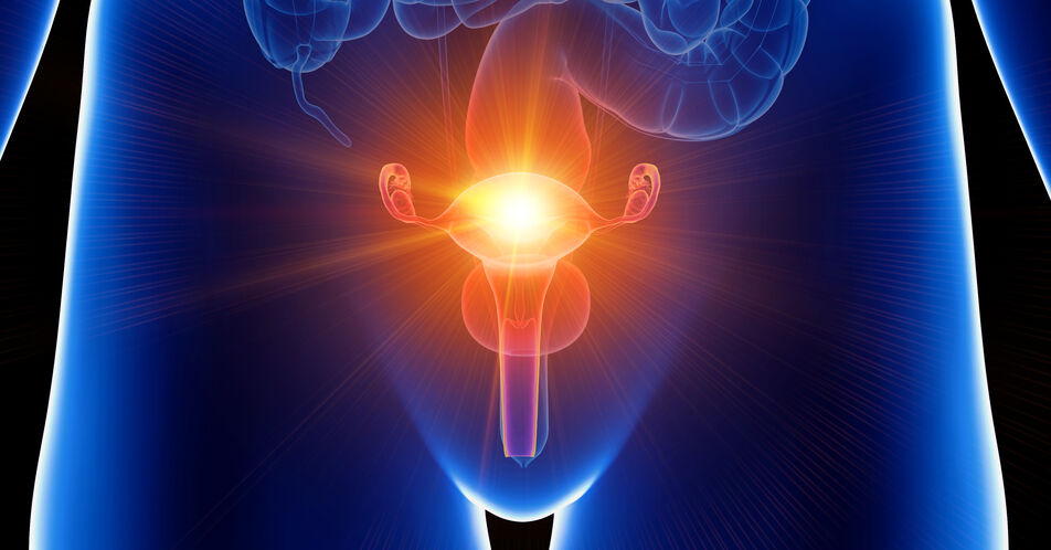 Endometriumkarzinom: Frühzeitiger Test auf genetische Instabilität