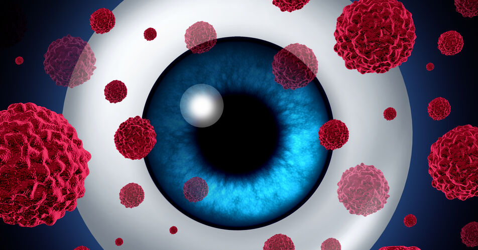 Retinoblastom: Wie die seltene Krebserkrankung am Auge entsteht