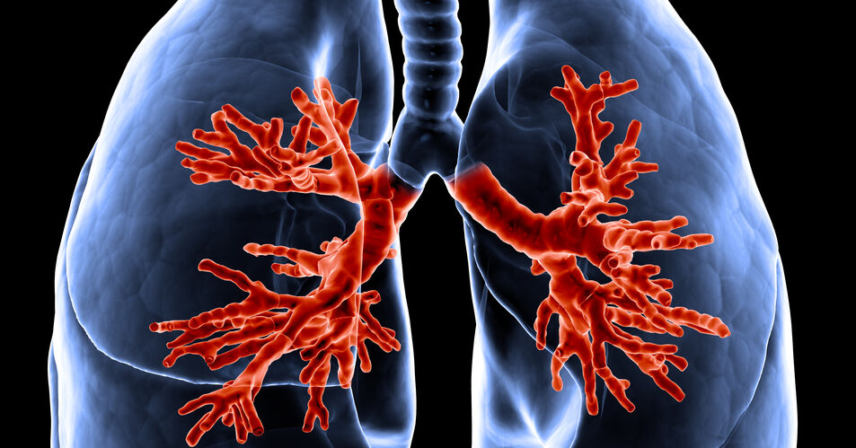 Feinstaubbelastung erhöht Lungenkrebsrisiko auch bei Nicht-Raucher:innen