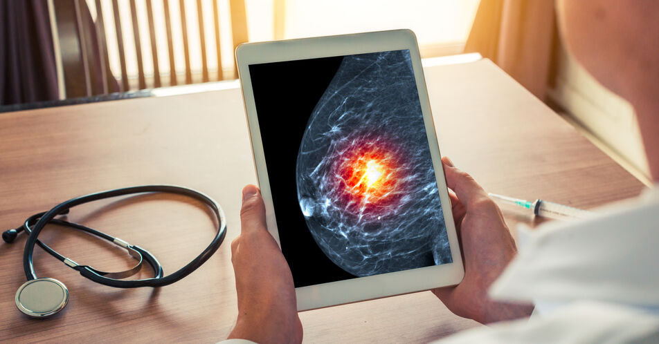 Röntgenkontrastmittel erhält Zulassungserweiterung für kontrastmittelverstärkte Mammographie