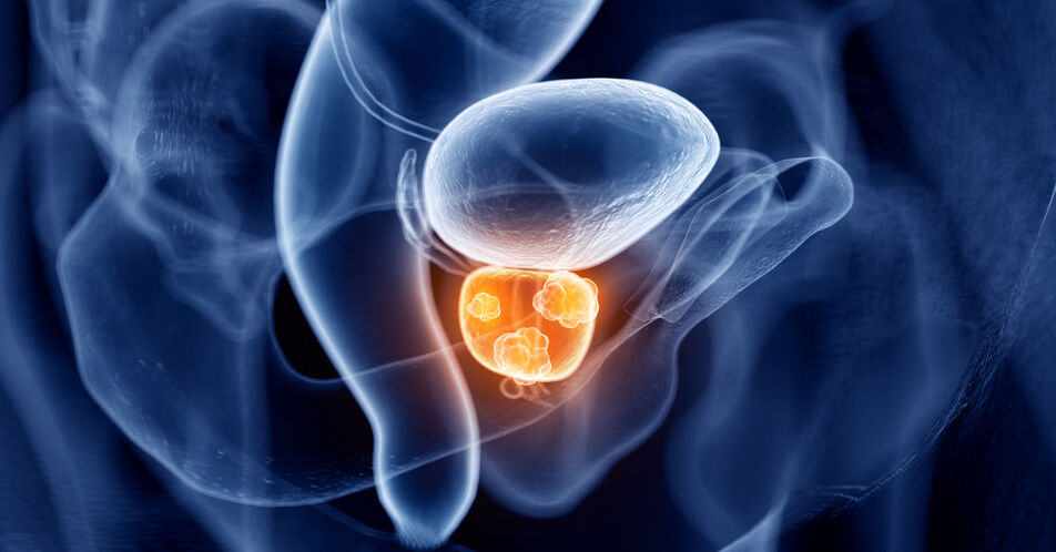Darolutamid erhält EU-Zulassung für metastasierten hormonsensitiven Prostatakrebs