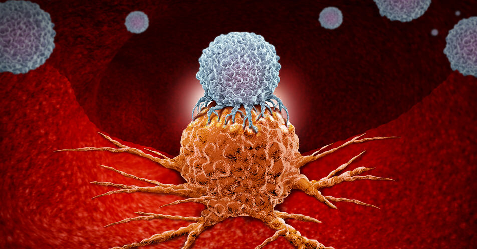 Neue Angriffsziele für die CAR-T-Zell-Therapie bei AML