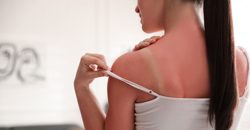 Hautkrebs: Schutz vor UV-Strahlung am Arbeitsplatz verbessern