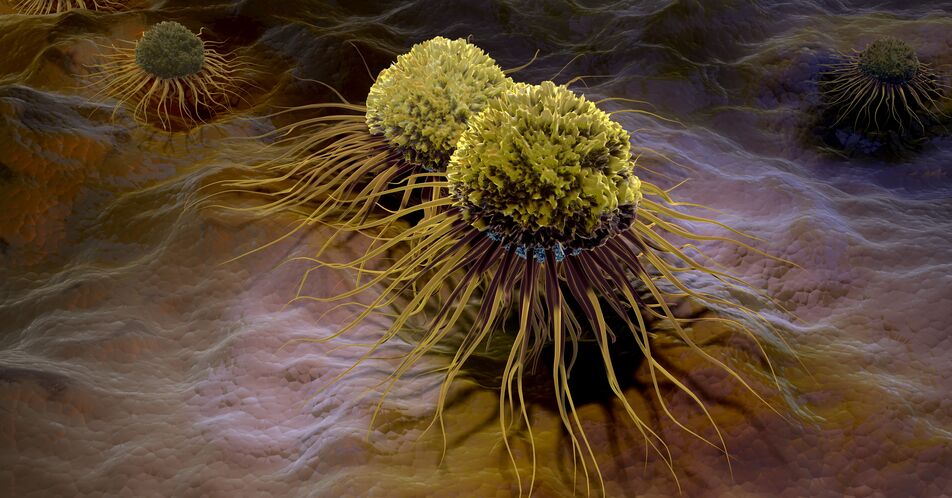 Flatliner-Krebszellen: Weiterleben trotz Zelltod-Signal