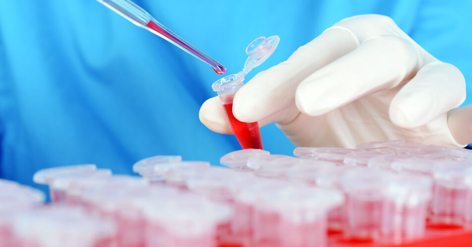 Neue Krebs-Bluttests: Warnung vor falschen Erwartungen