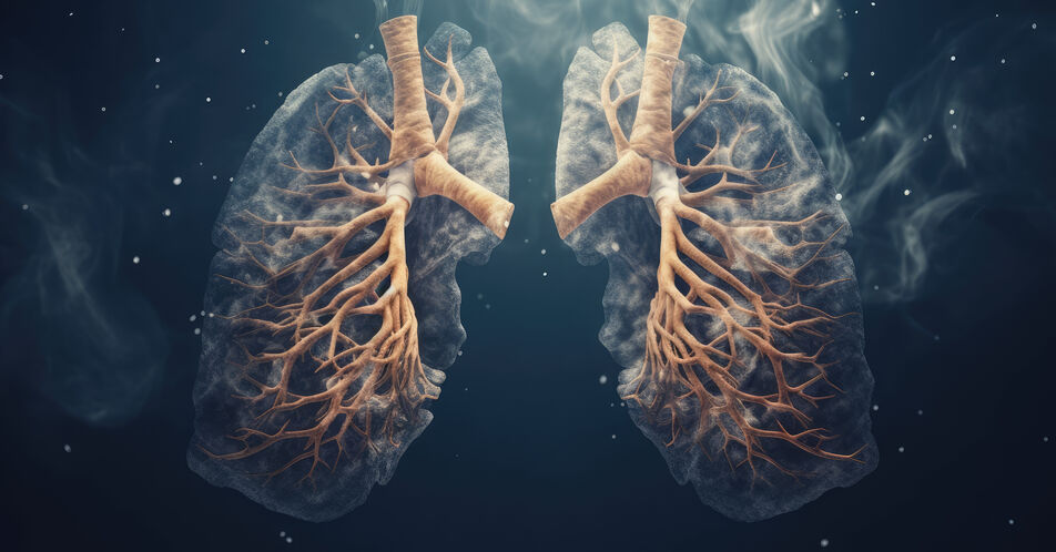 Ursachen für Lungenkrebs bei Jüngeren weniger bekannt