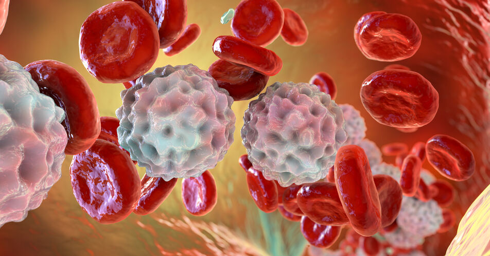 r/r LBCL: Baseline-Immunstatus und klonale Kinetik der T-Zellen assoziiert mit Ansprechen auf Axi-cel