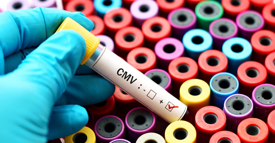 Therapiestrategien der CMV-Infektion bei Immundefizienten