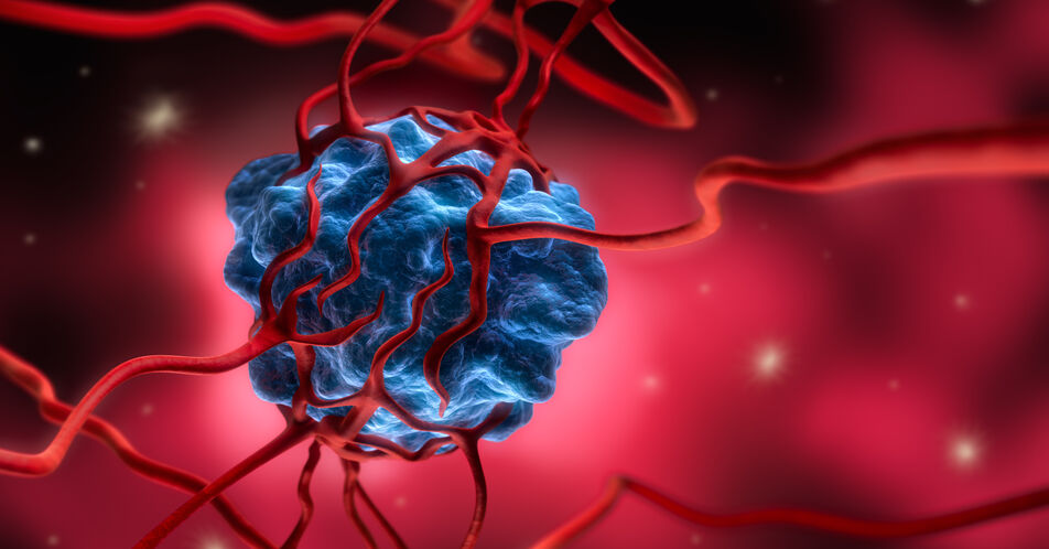 NSCLC und Magenkarzinom: Anti-Angiogenese stimuliert das Immunsystem