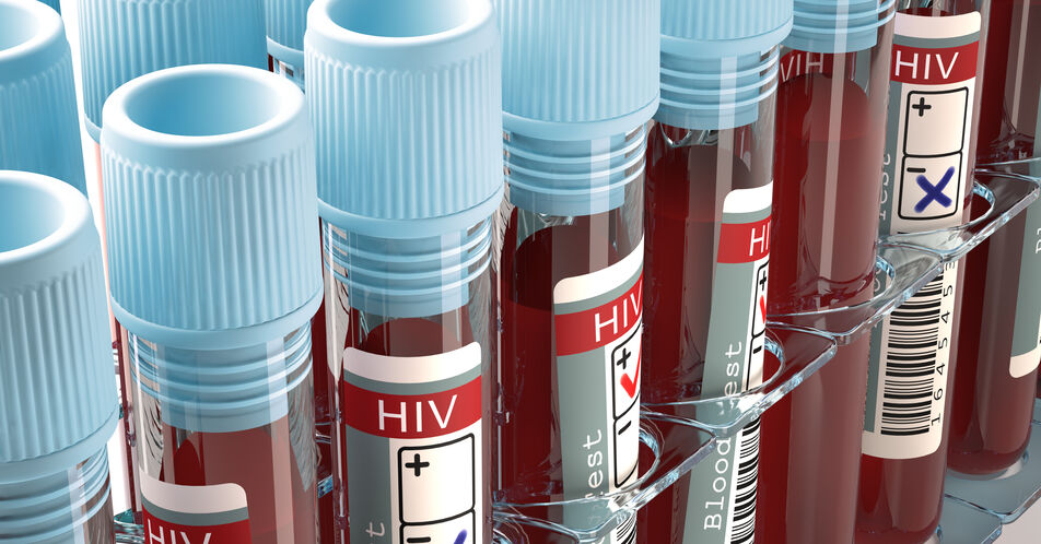 Ungleichbehandlung: HIV-positive Menschen mit DLBCL brauchen Zugang zu CAR-T-Zelltherapien