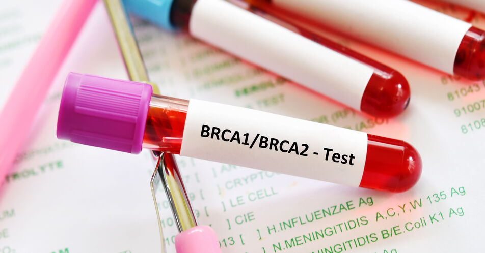 BRCA1/2-Keimbahnmutation beim Mammakarzinom: Testung ist therapierelevant!