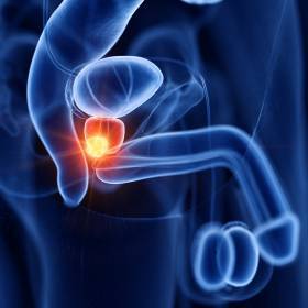 Prostatita adenomatoasa, Tratamentul adenomului de prostata