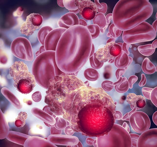 Blutkrebs – ein Begriff, viele Erkrankungen