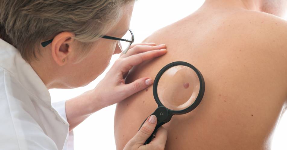 Hautkrebsreport: Nur jeder Sechste geht zur Früherkennung