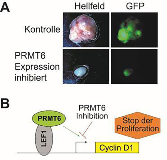 PRMT6-Inhibition als Ansatzpunkt für eine molekulare Therapie von Krebserkrankungen.